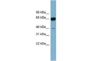 WB Suggested Anti-ZNF169 Antibody Titration:  0. (ZNF169 Antikörper  (N-Term))