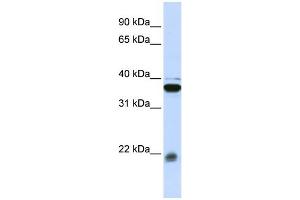 WB Suggested Anti-MYL9 Antibody Titration: 0.
