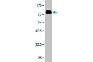 Western Blot detection against Immunogen (85. (ACD Antikörper  (AA 1-544))