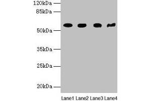 Western blot All lanes: KRT79 antibody at 1 μg/mL Lane 1: Mouse lung tissue Lane 2: A549 whole cell lysate Lane 3: 293T whole cell lysate Lane 4: Mouse gonadal tissue Secondary Goat polyclonal to rabbit IgG at 1/10000 dilution Predicted band size: 58 kDa Observed band size: 58 kDa (Cytokeratin 79 Antikörper  (AA 1-300))
