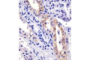 (ABIN6243380 and ABIN6577115) staining XI in human kidney sections by Immunohistochemistry (IHC-P - paraformaldehyde-fixed, paraffin-embedded sections).