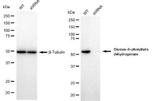 Western blotting analysis using Glucose-6-phosphate dehydrogenase antibody (ABIN7798733).