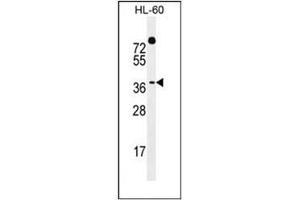 Western blot analysis of DUX4 / DUX10  Antibody  in HL-60 cell line lysates (35ug/lane). (DUX4 Antikörper  (Middle Region))