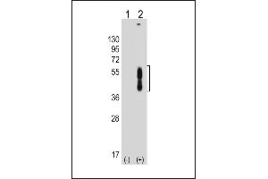 All lanes : Anti-PDCD1LG2 Antibody (N-term) at 1:8000 dilution Lane 1: Non-transfected 293T whole cell lysate Lane 2: Transfected PD-L2-transfected 293T whole cell lysate Lysates/proteins at 20 μg per lane. (PDCD1LG2 Antikörper  (N-Term))