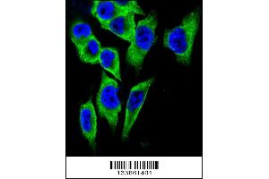 Confocal immunofluorescent analysis of LDHA Antibody with A375 cell followed by Alexa Fluor 488-conjugated goat anti-rabbit lgG (green). (Lactate Dehydrogenase A Antikörper  (C-Term))