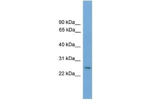 WB Suggested Anti-Dlx4 Antibody Titration: 0. (DLX4 Antikörper  (Middle Region))