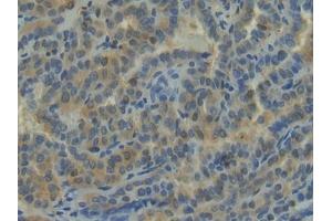 Immunohistochemistry (IHC) image for anti-Neuropilin 1 (NRP1) (AA 646-814) antibody (ABIN7432400)