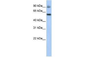 WB Suggested Anti-ASCC2 Antibody Titration:  0. (ASCC2 Antikörper  (Middle Region))