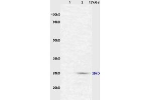 Lane 1: mouse intestine lysates Lane 2: mouse liver lysates probed with Anti CD161c/NK1. (NK-1.1/CD161c Antikörper  (AA 101-200))
