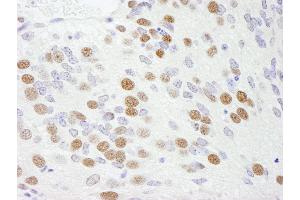 Immunohistochemistry (IHC) image for anti-RNA Binding Motif Protein 9 (RBM9) (AA 1-50) antibody (ABIN7448568)