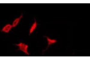 ABIN6278702 staining HepG2 by IF/ICC. (Varicella Zoster Virus Thymidine kinase (VZV TK) Antikörper)