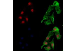 ABIN6257571 and ABIN6274504 staining Hela cells by IF/ICC. (ZNF541 Antikörper  (Internal Region))