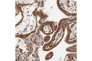 Immunohistochemical staining (Formalin-fixed paraffin-embedded sections) of human placenta shows strong adpositivity in trophoblastic cells.
