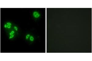 Immunofluorescence analysis of A549 cells, using TFIP8 Antibody. (Cytokeratin 5 Antikörper  (AA 31-80))