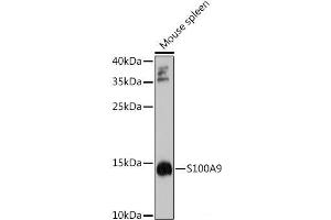 Western blot analysis of extracts of Mouse spleen using S100A9 Polyclonal Antibody at dilution of 1:1000. (S100A9 Antikörper)