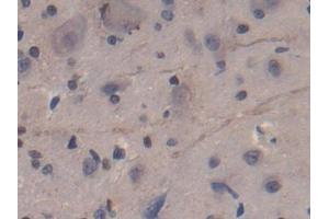 Used in DAB staining on fromalin fixed paraffin- embedded kidney tissue (CD8B Antikörper  (AA 21-208))