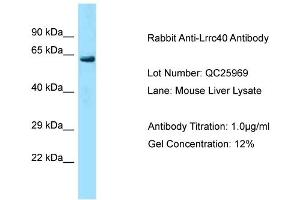 Host: Rabbit Target Name: Lrrc40 Sample Type: Mouse Liver Antibody Dilution: 1. (LRRC40 Antikörper  (C-Term))