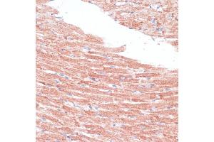 Immunohistochemistry of paraffin-embedded mouse heart using FZD4 antibody (ABIN6131550, ABIN6140841, ABIN6140842 and ABIN6224186) at dilution of 1:100 (40x lens). (FZD4 Antikörper  (AA 37-222))