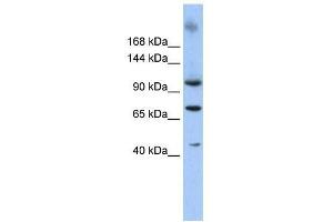 Western Blot showing TUT1 antibody used at a concentration of 1-2 ug/ml to detect its target protein. (TUT1 Antikörper  (N-Term))