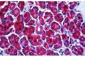 Human Pancreas: Formalin-Fixed, Paraffin-Embedded (FFPE) (PHGDH Antikörper  (AA 1-534))