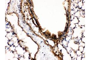 IHC testing of FFPE mouse lung with MKK7 antibody.