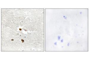 Immunohistochemistry analysis of paraffin-embedded human brain tissue using ZNF287 antibody. (ZNF287 Antikörper  (Internal Region))