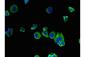 Immunofluorescent analysis of MCF-7 cells using ABIN7175490 at dilution of 1:100 and Alexa Fluor 488-congugated AffiniPure Goat Anti-Rabbit IgG(H+L) (SEC22A Antikörper  (AA 10-187))