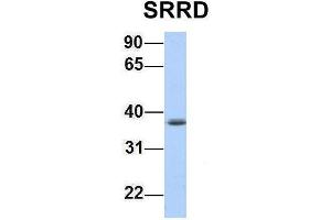 Host:  Rabbit  Target Name:  SRRD  Sample Type:  Jurkat  Antibody Dilution:  1. (SRRD Antikörper  (Middle Region))
