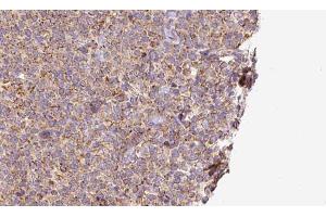 Immunohistochemistry (IHC) image for anti-Solute Carrier Family 10 (Sodium/bile Acid Cotransporter Family), Member 2 (SLC10A2) (C-Term) antibody (ABIN6260071)