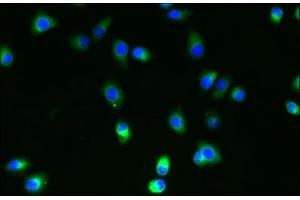 Immunofluorescent analysis of A2780 cells using ABIN7174666 at dilution of 1:100 and Alexa Fluor 488-congugated AffiniPure Goat Anti-Rabbit IgG(H+L) (SLC35B4 Antikörper  (AA 174-200))