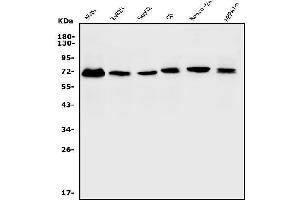 Western blot analysis of ERM/Etv5 using anti-ERM/Etv5 antibody (ABIN7602370).
