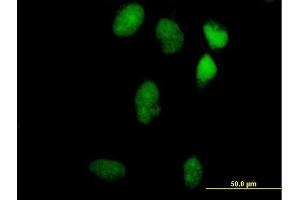 Immunofluorescence of purified MaxPab antibody to LIN9 on HeLa cell. (LIN9 Antikörper  (AA 1-558))
