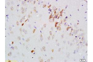 Formalin-fixed and paraffin embedded rat brain labeled with Anti-GDNF-Receptor-alpha-2 Polyclonal Antibody, Unconjugated 1:200 followed by conjugation to the secondary antibody and DAB staining (GFRA2 Antikörper  (AA 301-360))