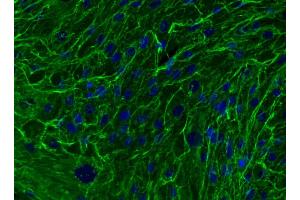 Immunofluorescent analysis of Fibronectin in mesenchymal stem cells (MSC). (Fibronectin Antikörper)