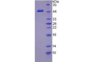 SDS-PAGE analysis of Human WT1 Protein. (WT1 Protein)