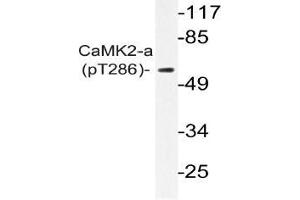 Western blot (WB) analysis of p-CaMK2-a antibody in extracts from A431 EGF cells (CAMK2A Antikörper  (pThr286))