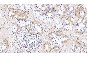 Immunohistochemistry (IHC) image for anti-Caspase 7, Apoptosis-Related Cysteine Peptidase (CASP7) (AA 24-198) antibody (ABIN7437974)