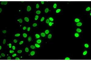 Immunofluorescence analysis of HeLa cells using SEPT7 Polyclonal Antibody (Septin 7 Antikörper)