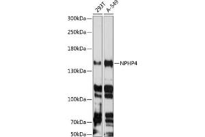 Western blot analysis of extracts of various cell lines, using NPHP4 antibody  at 1:3000 dilution. (NPHP4 Antikörper  (AA 1247-1426))