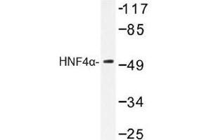 Image no. 1 for anti-Hepatocyte Nuclear Factor 4, alpha (HNF4A) antibody (ABIN317780)