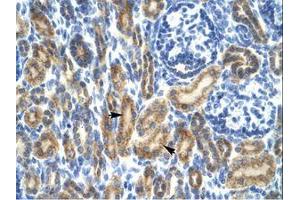 Image no. 1 for anti-Hematopoietic Cell-Specific Lyn Substrate 1 (HCLS1) (AA 28-77) antibody (ABIN202645) (HCLS1 Antikörper  (AA 28-77))
