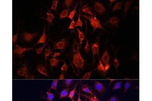 Immunofluorescence analysis of C6 cells using UCP3 Polyclonal Antibody at dilution of 1:100. (UCP3 Antikörper)