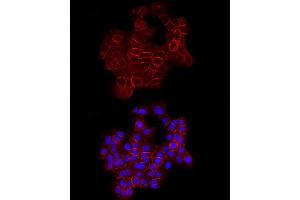 Immunofluorescence (IF) image for anti-Cadherin 1, Type 1, E-Cadherin (Epithelial) (CDH1) (AA 700-800) antibody (ABIN6138279)