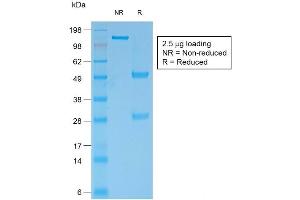 SDS-PAGE Analysis of Purified BCL2 Mouse Recombinant Monoclonal Antibody ABIN6383841. (Rekombinanter Bcl-2 Antikörper)