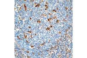 Immunohistochemistry (IHC) image for anti-Vimentin (VIM) (AA 325-375) antibody (ABIN7449539) (Rekombinanter Vimentin Antikörper  (AA 325-375))