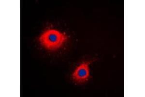 Immunofluorescence (IF) image for anti-Keratin 7 (KRT7) (C-Term) antibody (ABIN7296130)