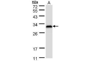 WB Image Sample (30 ug of whole cell lysate) A: HeLa S3 , 12% SDS PAGE antibody diluted at 1:1000 (RANBP1 Antikörper)