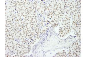 Immunohistochemistry (IHC) image for anti-REST Corepressor 3 (RCOR3) (AA 445-495) antibody (ABIN7449047) (RCOR3 Antikörper  (AA 445-495))