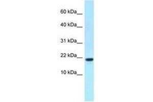 Image no. 1 for anti-X Antigen Family, Member 1D (XAGE1D) (C-Term) antibody (ABIN6747882) (XAGE1D Antikörper  (C-Term))