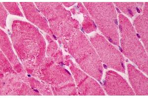 Human Skeletal Muscle: Formalin-Fixed, Paraffin-Embedded (FFPE) (RNF2 Antikörper  (AA 189-201))